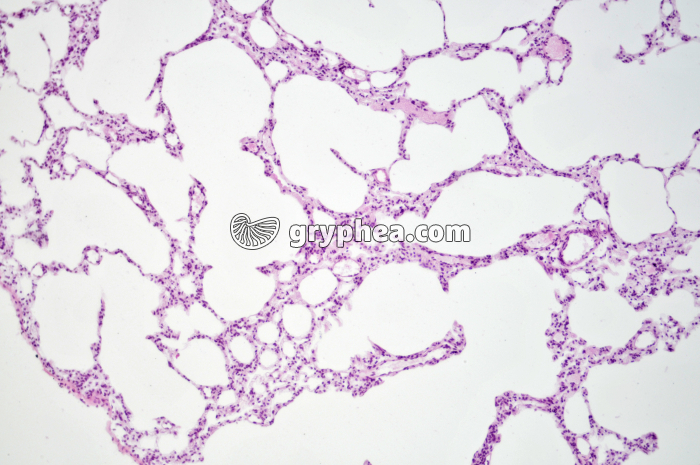 Poumon Rat x40 - gryphea.org